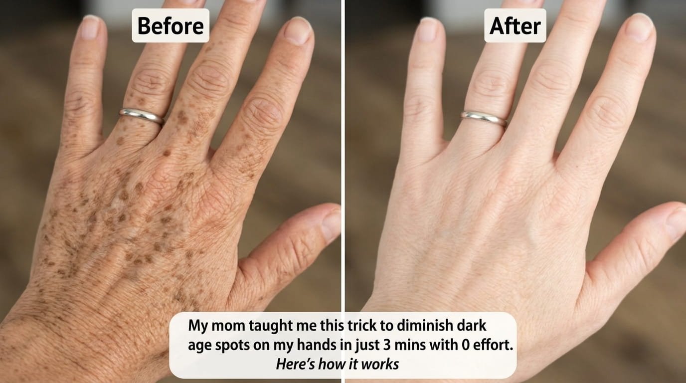 Mom’s 3-Minute Hand Brightening Remedy